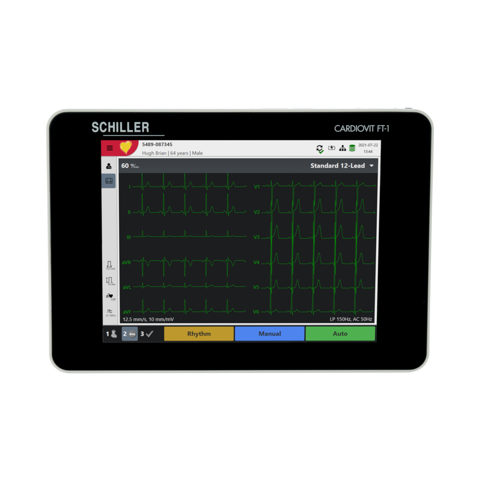 Schiller CARDIOVIT FT-1 – Medprozone Mexico